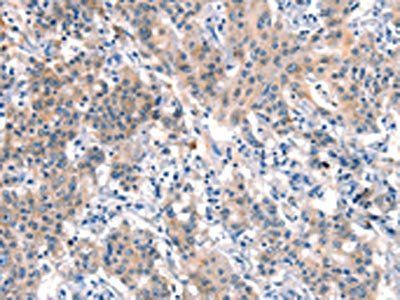 DOCK1 Antibody