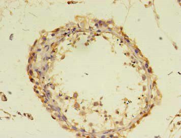 DOCK10 Antibody