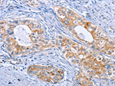 DOK4 Antibody
