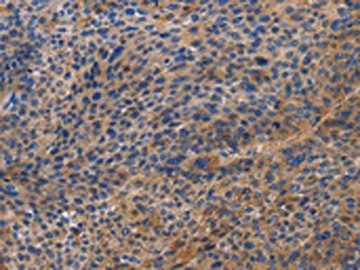 DOK4 Antibody