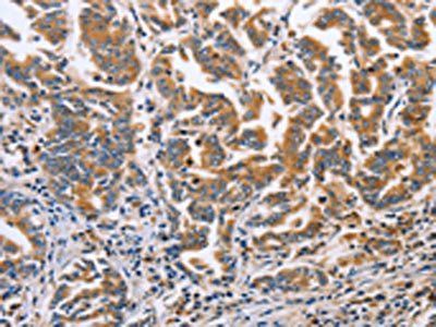 DOK4 Antibody