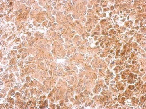Dopamine beta Hydroxylase Rabbit Polyclonal Antibody