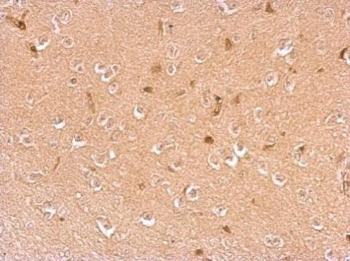 Dopamine beta Hydroxylase Rabbit Polyclonal Antibody
