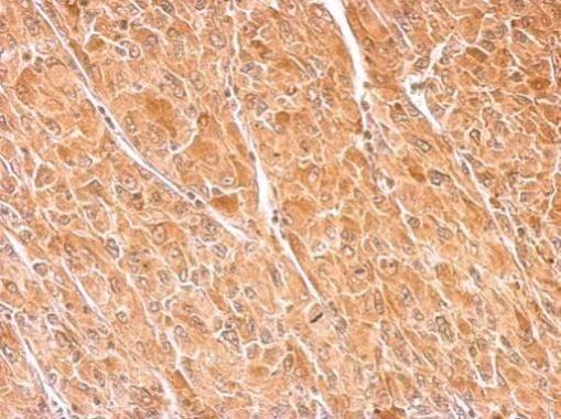 Dopamine beta Hydroxylase Rabbit Polyclonal Antibody