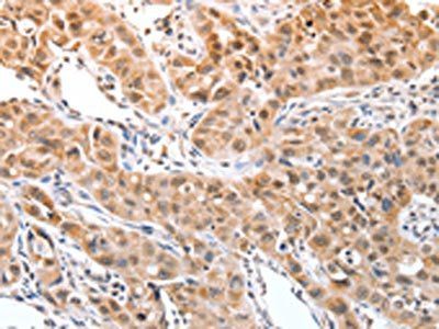 DPPA2 Antibody