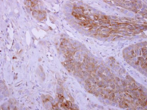 DPYD Rabbit Polyclonal Antibody