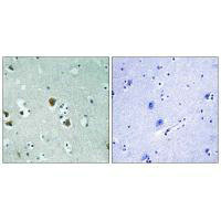 DPYSL2 Antibody