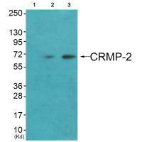 DPYSL2 Antibody