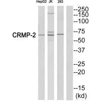 DPYSL2 Antibody