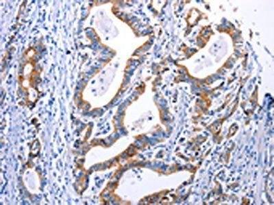 DRD4 Antibody