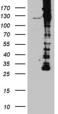DBN1 Antibody