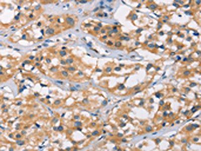 DSC2 Antibody