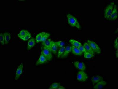 DSC3 Antibody