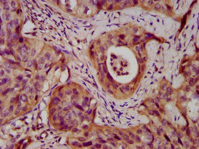 DSC3 Antibody