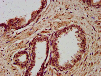 DSC3 Antibody