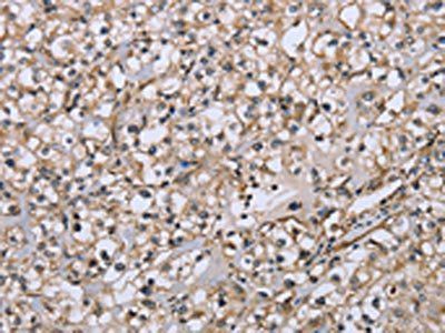 DTNB Antibody