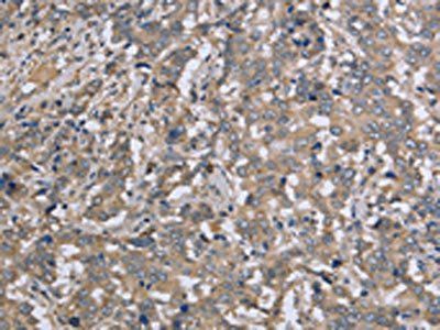 DTNB Antibody