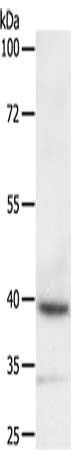 DTX3 Antibody