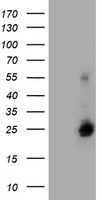 DTYMK Antibody