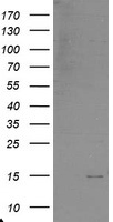 DTYMK Antibody