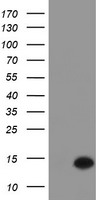DTYMK Antibody