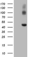 DTYMK Antibody
