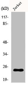 DTYMK Antibody