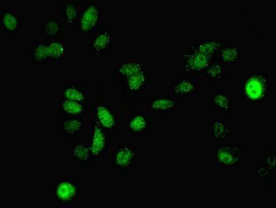 MAP2K3 Antibody