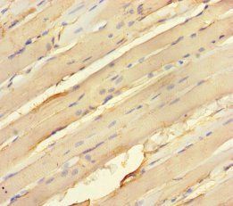 MAP2K3 Antibody