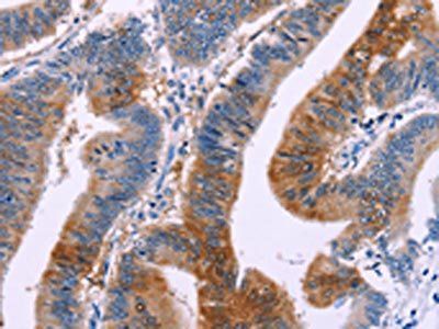DUSP13 Antibody