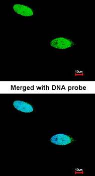 DUSP26 Rabbit Polyclonal Antibody