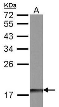 DUSP26 Rabbit Polyclonal Antibody