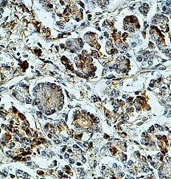 DUSP6 Rabbit Polyclonal Antibody