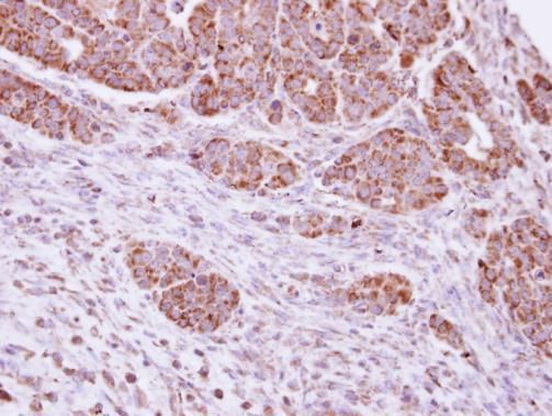 DUSP7 Rabbit Polyclonal Antibody