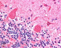 Dynactin Antibody