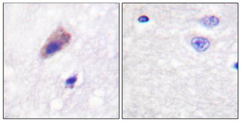 Dynamin-1 (Phospho-Ser774) Antibody
