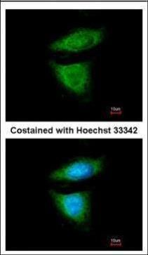 DYNC1I2 Rabbit Polyclonal Antibody