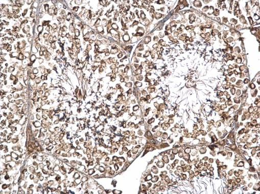 DYNC1I2 Rabbit Polyclonal Antibody