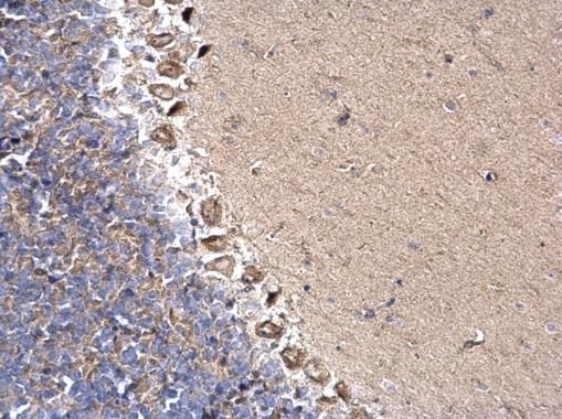 DYNC1I2 Rabbit Polyclonal Antibody