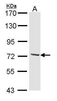 DYNC1I2 Rabbit Polyclonal Antibody