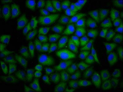 DYSF Antibody