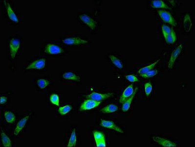 DNAAF4 Antibody