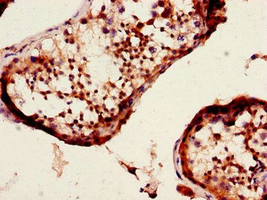 DNAAF4 Antibody