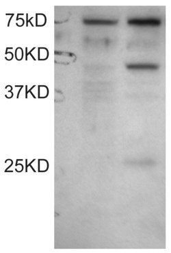 DYX1C1 (Isoform a) Antibody