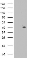 E-Cadherin(CDH1) Antibody