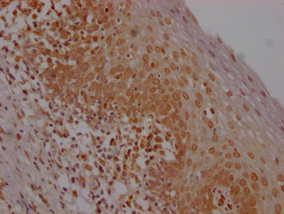 E2F1 Antibody