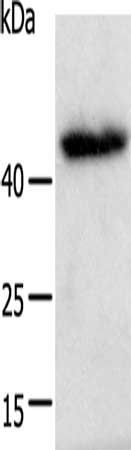 E2F2 Antibody