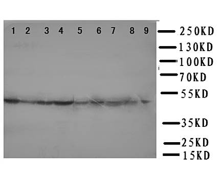 Transcription factor E2F2 E2F2 Rabbit Polyclonal Antibody