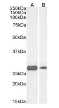 PGAM1/PGAM2/PGAM4 Antibody