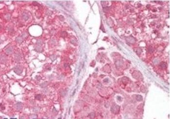 Goat anti-SLC16A7 / MCT2 Antibody
